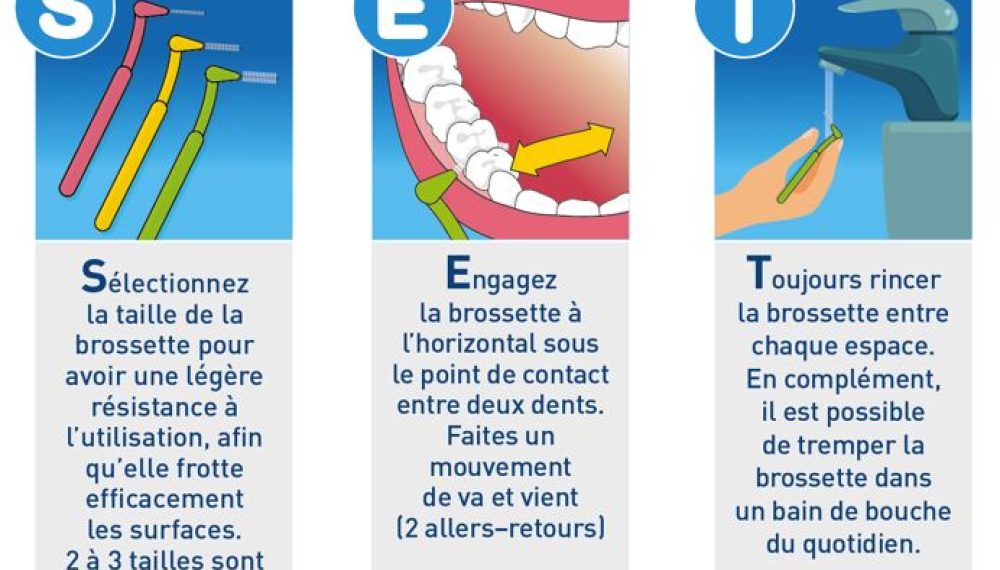 Capture-methode-fil Capture-methode-fil