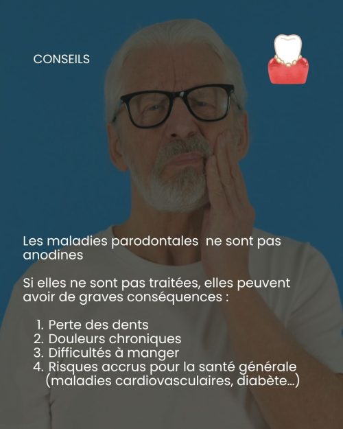 maladies-paradontales (2)